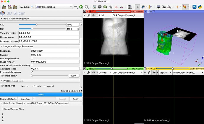 plastimatch, how to set up plastimatch, clinic workflow with snapshots and restore points